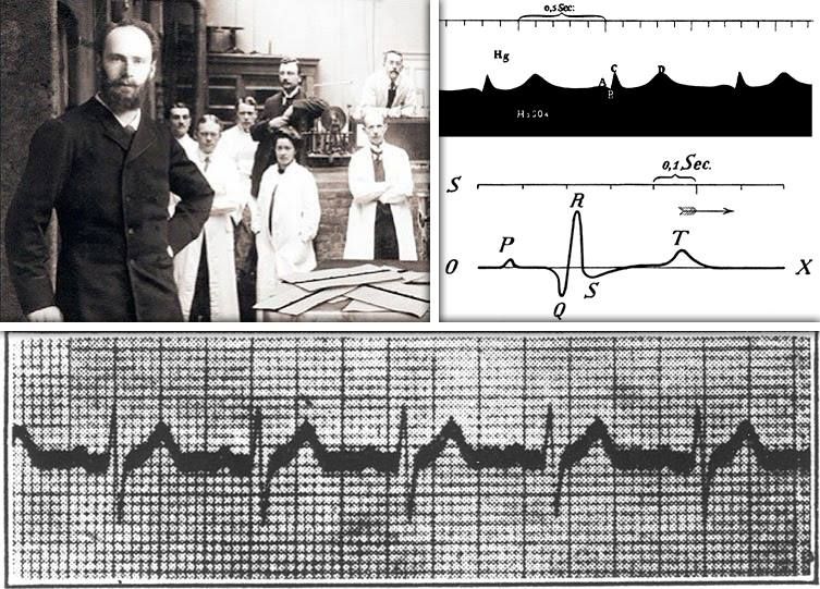 The Birth of ECG