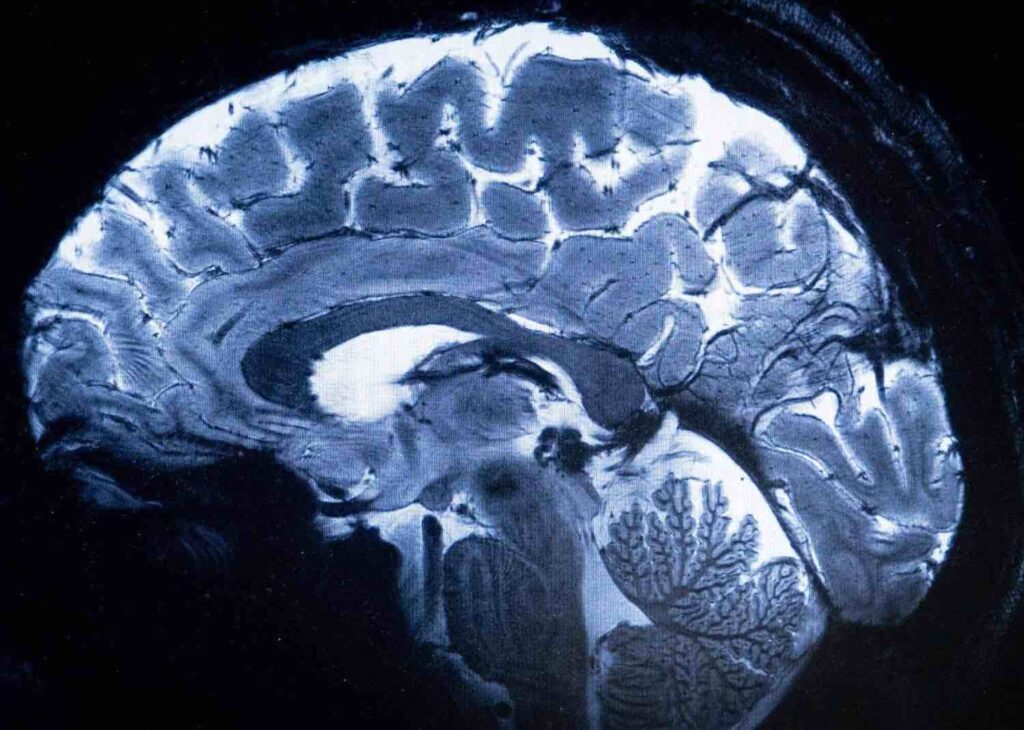 First magnetic resonance image of the human brain