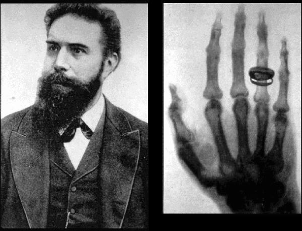 The First Radiography