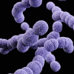 Microplastics